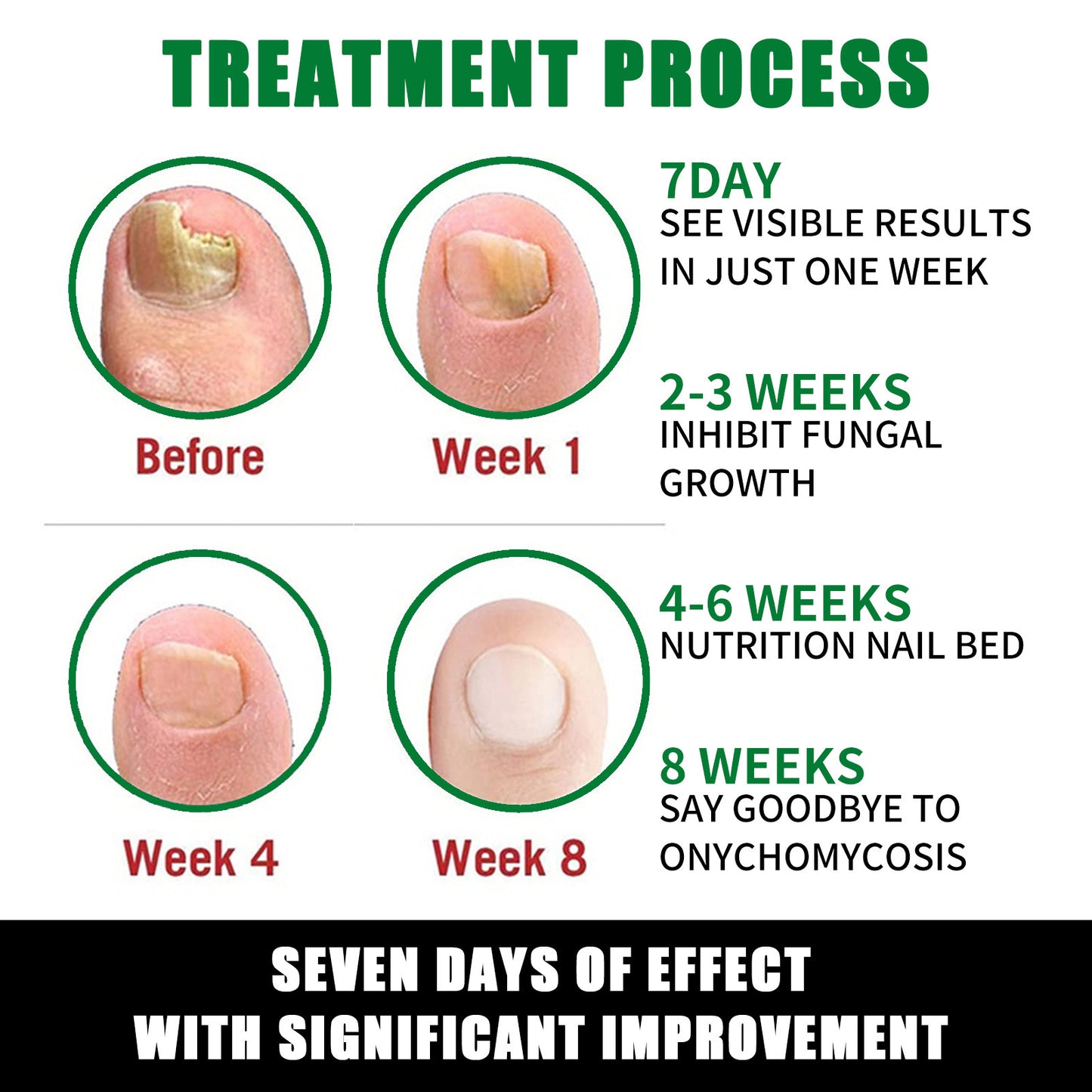 7 Days Nail Fungus Treatment